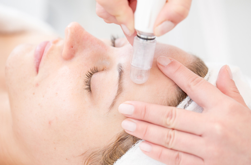 Treatments - Microdermabrasion