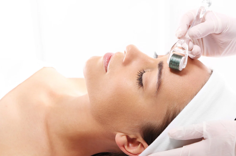 Treatments - Microneedling